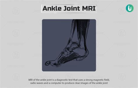 Ankle Joint MRI: Procedure, Purpose, Results, Cost, Price, Online Booking