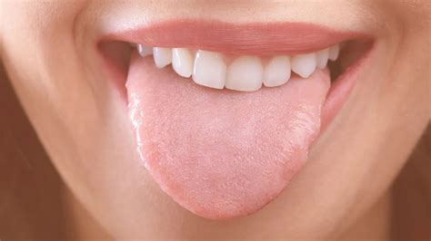 Teeth Marks On Tongue: Causes & Prevent At Spring Orchid Dental