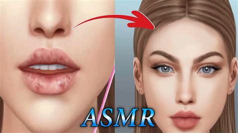 ASMR Coolness! Ingrown Toenail removal treatment animation Episode Part ( 1 ) - YouTube