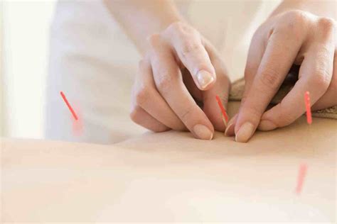 Acupuncture For Mild Depression