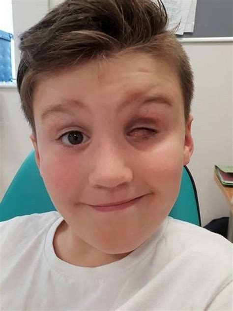 Toy accident: 9yo boy loses eye after being shot with Nerf gun | news.com.au — Australia’s ...