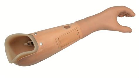 Prosthetics Arm Myoelectric Hand Prosthesis, Thickness: 3mm, Size: Large, Rs 130000 /unit | ID ...