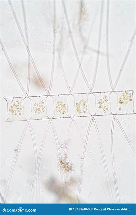 Chaetoceros is the Largest Genus of Marine Planktonic Diatoms Stock Photo - Image of food ...