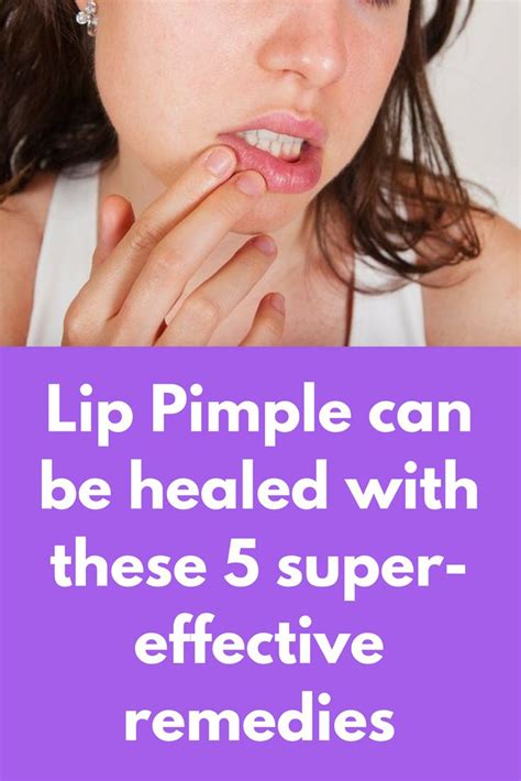 Lip Pimple can be healed with these 5 super-effective remedies | Pimples, Pimples remedies