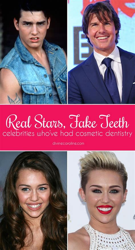 Real Stars, Fake Teeth: 20 Celebrities Who Have Had Cosmetic Dentistry - More | Celebrity teeth ...