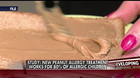 Researchers Tout Possible Breakthrough on Curing Peanut Allergies | Food allergy treatment ...