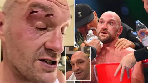 Tyson Fury may never 'fight again' after postponing Oleksandr Usyk ...