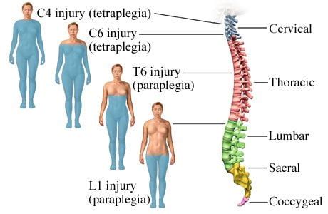 Stem Cell Treatment for Spinal Cord Injuries SCI Therapy