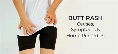 Butt Rash: Possible Causes, Symptoms & Remedies | Daily Health Cures