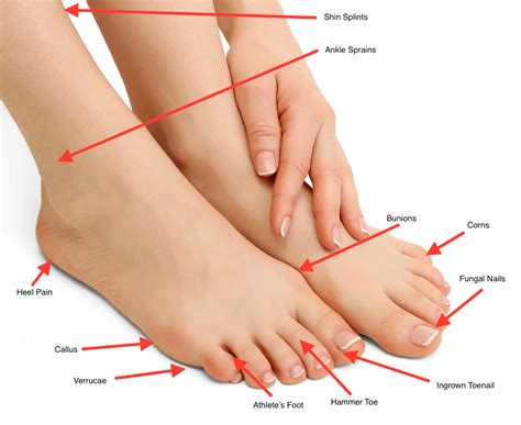 Types Of Foot Problems - Design Talk