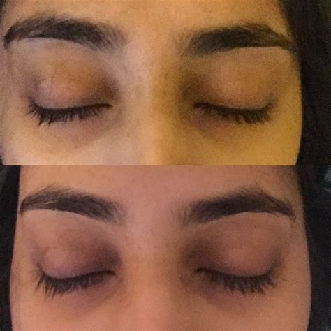 List 93+ Pictures Castor Oil For Wrinkles Before And After Pics Stunning