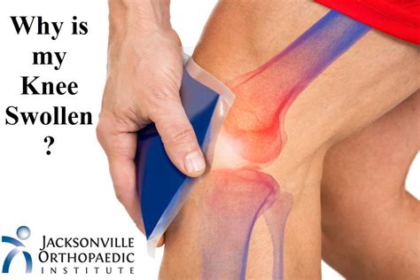 Swollen Knee Treatment Clearance | cityofclovis.org