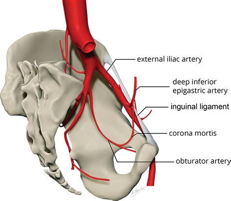 Multidetector CT in Vascular Injuries Resulting from Pelvic Fractures: A Primer for Diagnostic ...