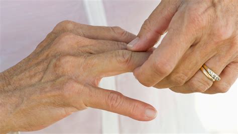 Finger joint pain: Causes, symptoms, and treatment (2022)