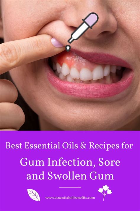 Best Essential Oils For Gum Infection, Pain And Swollen Gums ...