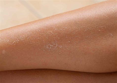 How to Get Rid of Dry Skin on Legs — Moody Sisters Skincare