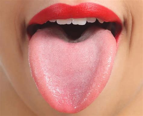 Spots on tongue: Causes and when to see a doctor (2022)