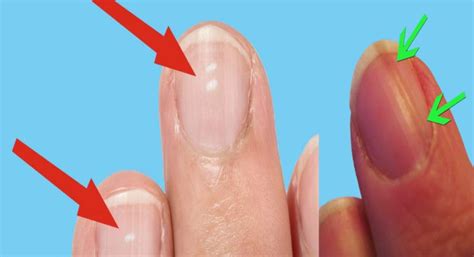 10 nail symptoms and what they mean for your health