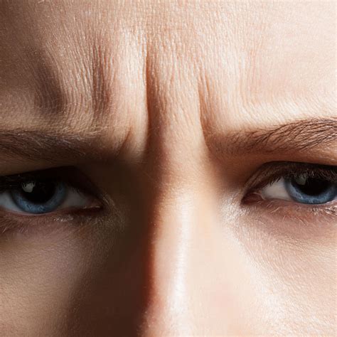 5 Types of Wrinkles and How to Tackle Each One - NewBeauty