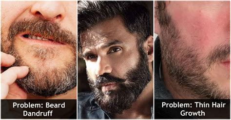 Beard Hair Texture