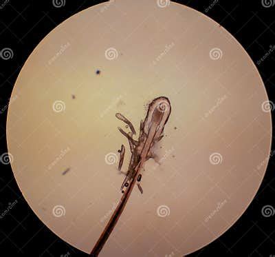 Demodex Folliculorum - Parasitic Mite on the Eyelashes of a Human Eye Stock Image - Image of ...