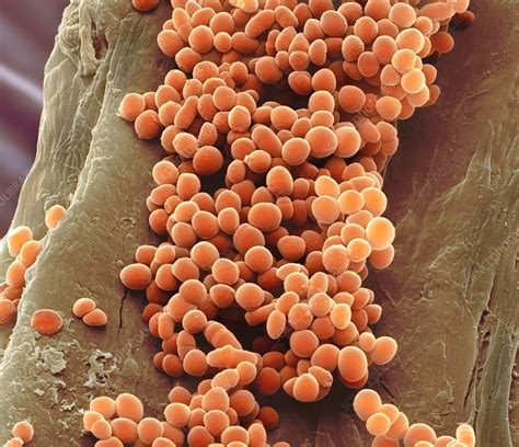 Lactococcus Lactis Gram Stain