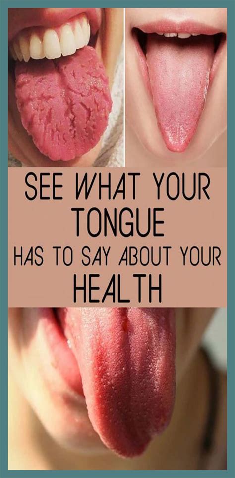 What Your Tongue Is Trying To Tell About Your Health - http://healthylivingmethod.com | Tongue ...