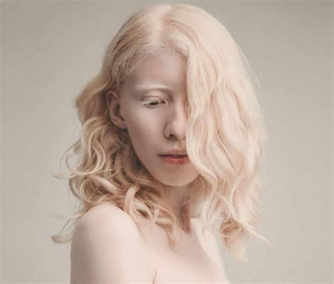 58 Albino People Who’ll Mesmerize You With Their Otherworldly Beauty ...