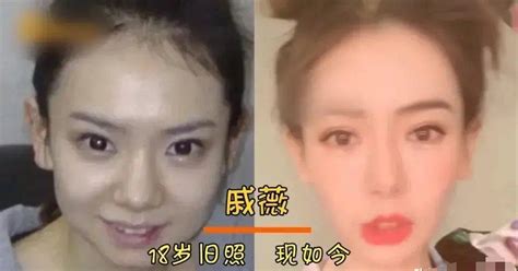 The celebrity hasn't had any plastic surgery, just look at the appearance of eighteen years old ...