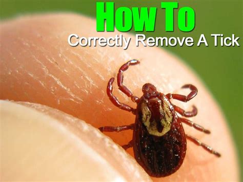 How To Remove A Tick Lyme Disease - HOWTORMEOV