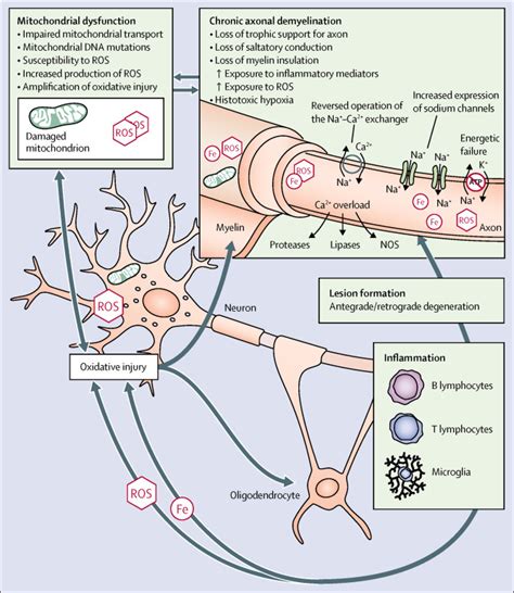 Progressive multiple sclerosis: prospects for disease therapy, repair, and restoration of ...