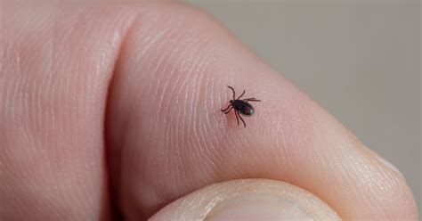 Alpha-gal syndrome, a meat allergy caused by lone star ticks, is ...