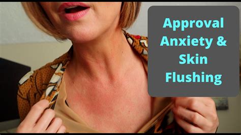 Approval Anxiety And Skin Flushing - Erythrophobia - YouTube