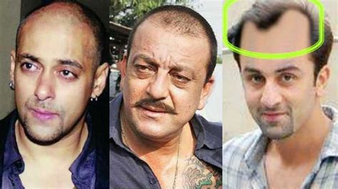 Top 11 Bollywood Actors Who Went For Hair Transplant - vrogue.co