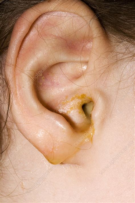 English Lab Ear Infection at Mable Cilley blog