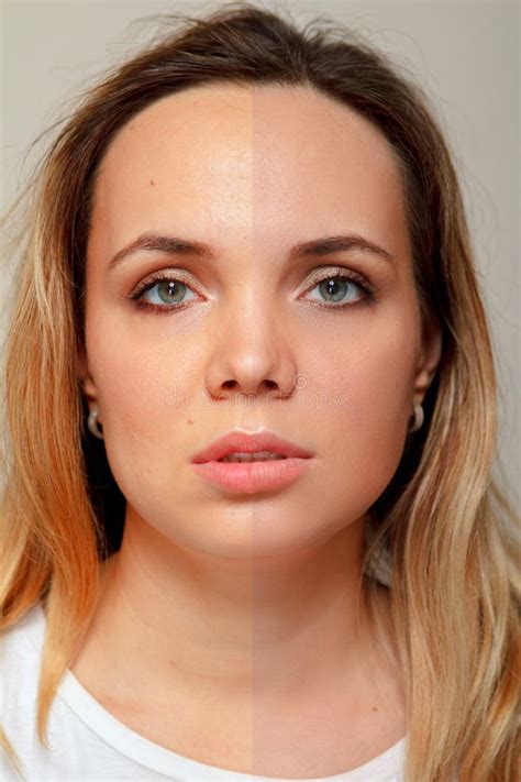 Retouch - Face of Beautiful Young Woman before and after. Stock Photo - Image of blemishes ...