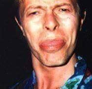 The side-effects of Bowie