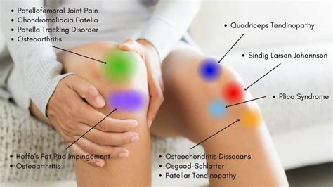 Knee Pain Location Chart | Learn the Pain Location of Knee Injuries