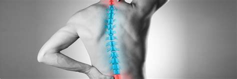 Cervical Myelopathy Surgery in NYC: Unmatched Expertise | Rothman ...