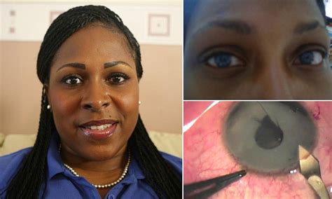 'I wanted to change my eye colour with surgery - but ended up blind ...