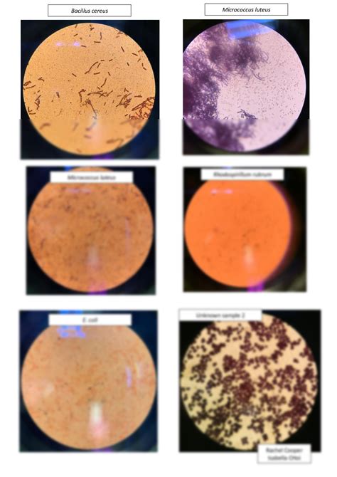 SOLUTION: Gram staining Images Lab Report - Studypool