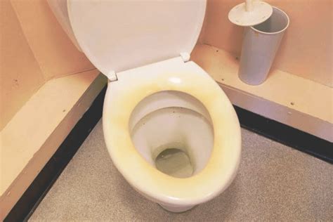 What causes yellow stains on toilet seat? | updated August 2022