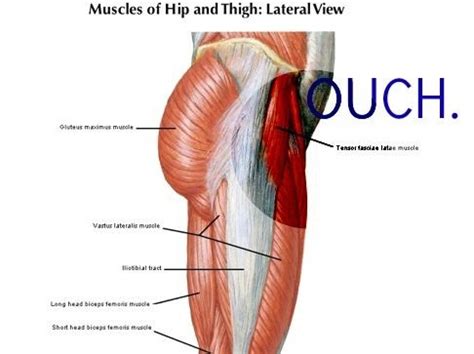 micro tears in muscle fibres - Google Search | Muscle, Muscle health, Hip stretches