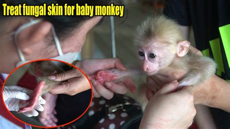Take baby monkeys to veterinary hospital to treat fungal skin | Rescue depression baby monkey ...