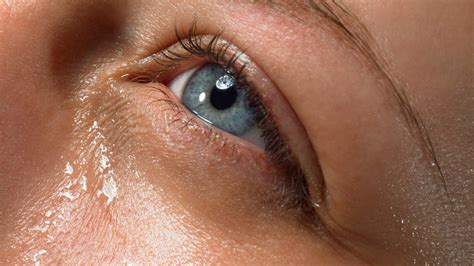 Trachoma- Symptoms, Causes, Diagnosis, Prevention, And Management