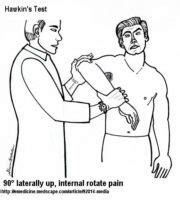 4 Shoulder Impingement Tests to Differentiate from AC Joint Injury ...