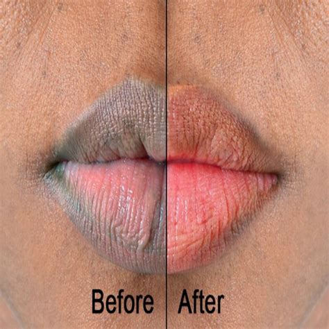 Permanent Pink Lips Balm Lightening Lip Balm for Succulent - Etsy