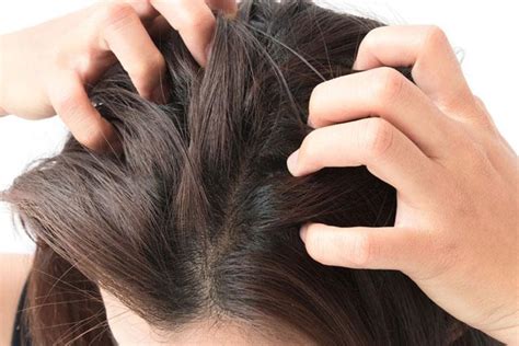 How to Deal With Sensitive Scalp