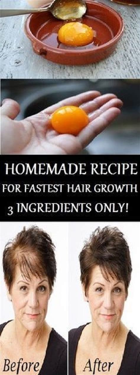 The Magic Homemade Recipe For Fastest Hair Growth! 3 Ingredients Only ...