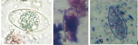 Oocystes de Cyclospora cayetanensis vus au microscope optique objectif... | Download Scientific ...